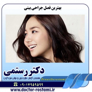 بهترین-فصل-جراحی-بینی