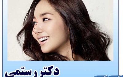 بهترین فصل جراحی بینی