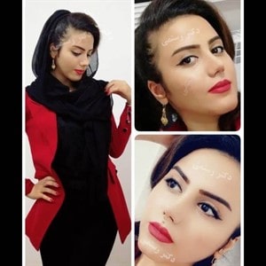 عکس نمونه از جراحی بینی دکتر رستمی