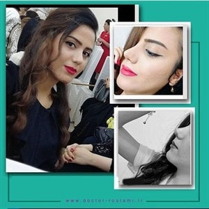 مراجعه کننده زیبا جراحی توسط دکتر رستمی