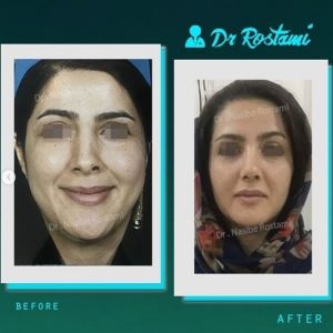 نمونه ی واقعی جراحی دکتر نصیبه رستمی
