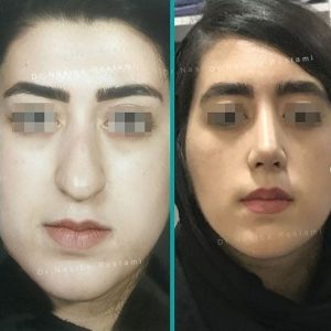 نمونه رضایتمندی از جراحی دکتر نصیبه رستمی