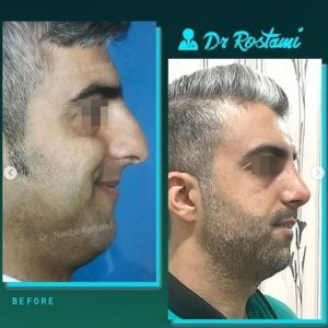 رضایت مراجعه کننده عزیز از جراحی دکتر نصیبه رستمی