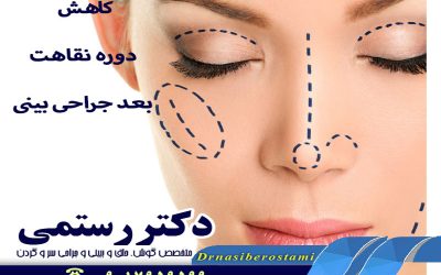 کاهش دوره نقاهت بعد از جراحی بینی