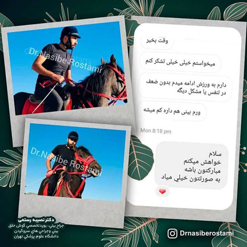 نمونه رضایت از جراحی زیبایی بینی