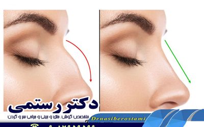 مشخصات بینی های استخوانی