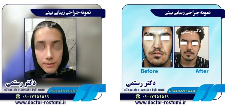 نمونه جراحی دکتر رستمی