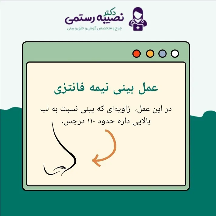 زاویه عمل بینی نیمه فانتزی